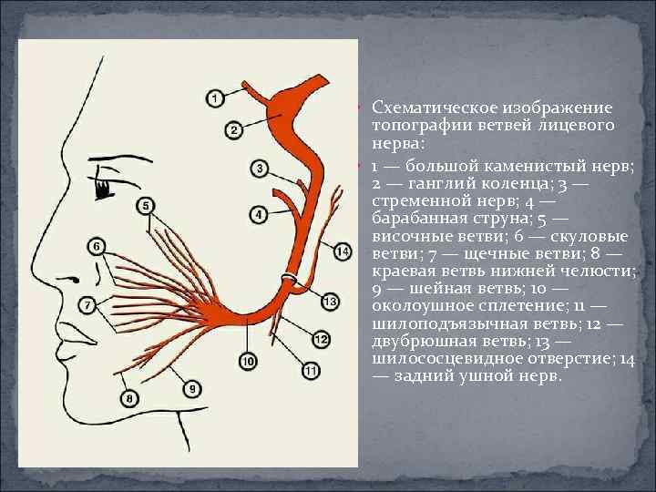  Схематическое изображение топографии ветвей лицевого нерва: 1 — большой каменистый нерв; 2 —