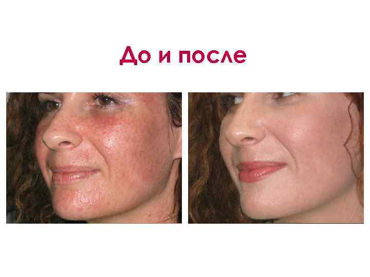 До и после 