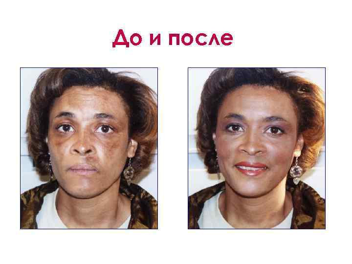 До и после 