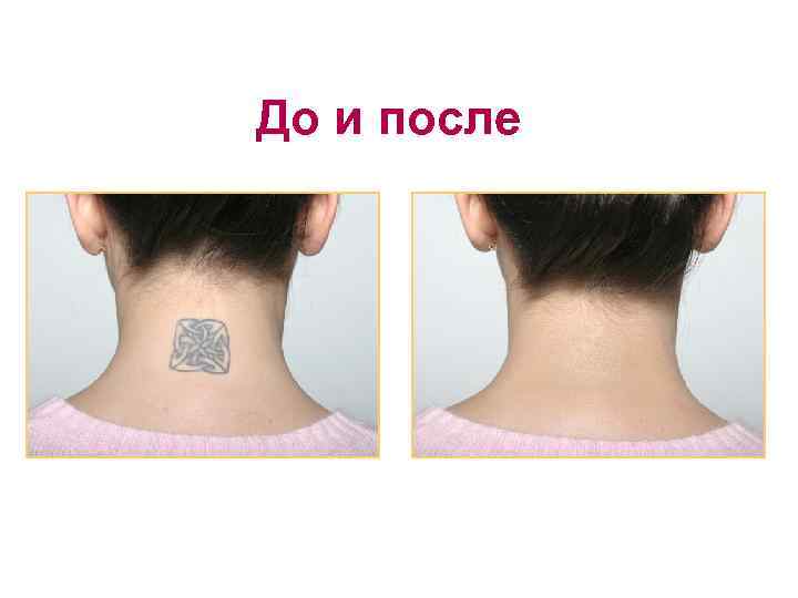 До и после 