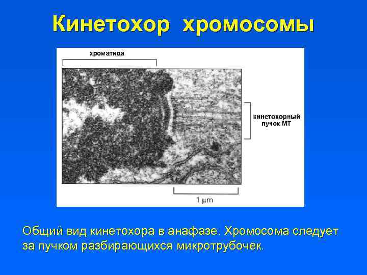 Кинетохор хромосомы Общий вид кинетохора в анафазе. Хромосома следует за пучком разбирающихся микротрубочек. 