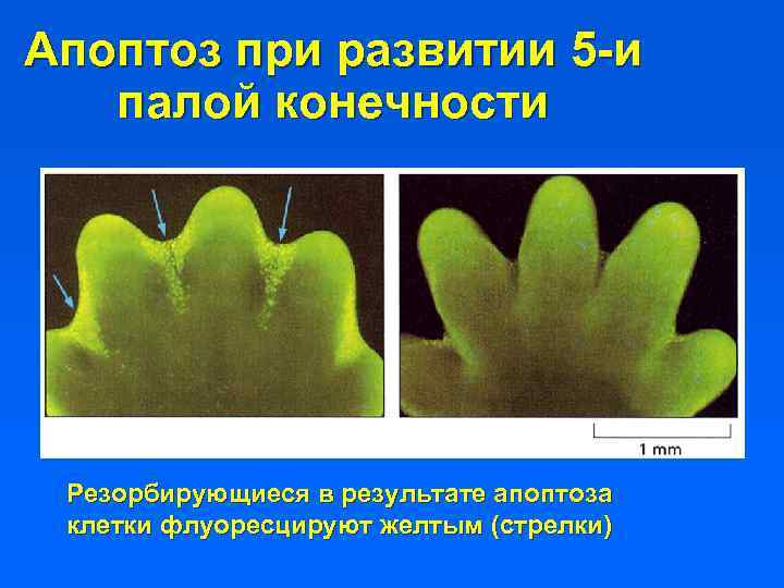 Апоптоз при развитии 5 -и палой конечности Резорбирующиеся в результате апоптоза клетки флуоресцируют желтым
