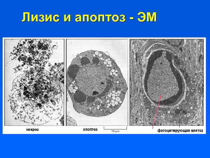 Лизис и апоптоз - ЭМ 