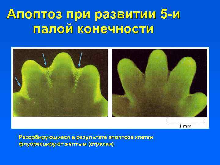 Апоптоз при развитии 5 -и палой конечности Резорбирующиеся в результате апоптоза клетки флуоресцируют желтым
