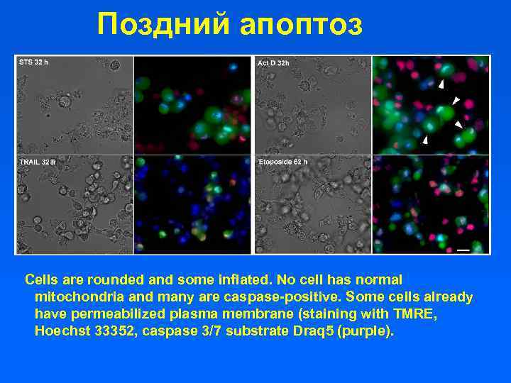 Поздний апоптоз Cells are rounded and some inflated. No cell has normal mitochondria and