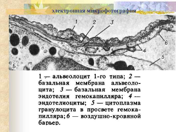 электронная микрофотография 