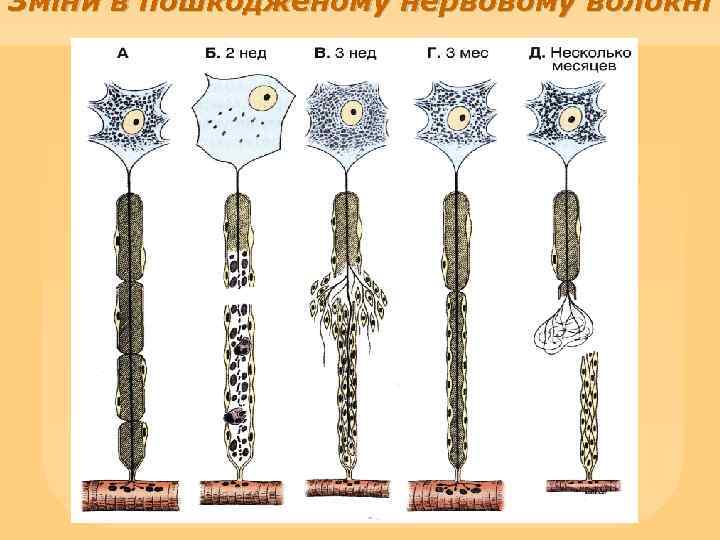Зміни в пошкодженому нервовому волокні 