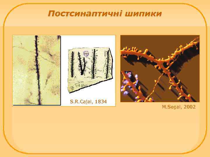 Постсинаптичні шипики S. R. Cajal, 1834 M. Segal, 2002 