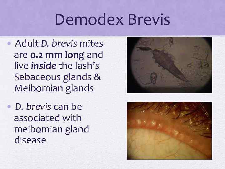 Demodex Brevis • Adult D. brevis mites are 0. 2 mm long and live