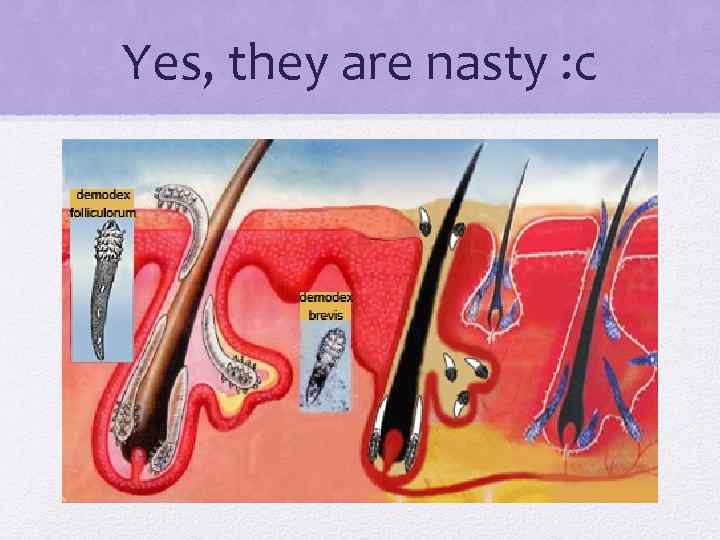 Yes, they are nasty : c 
