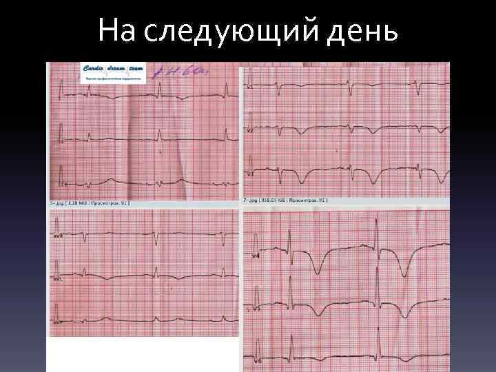 На следующий день 