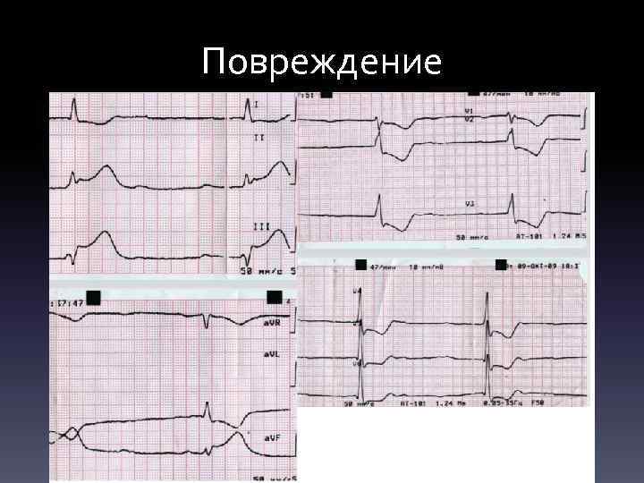Повреждение 