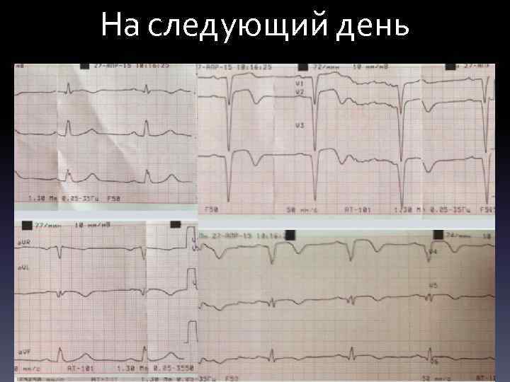 На следующий день 