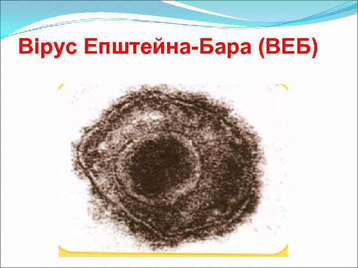 Вірус Епштейна-Бара (ВЕБ) 