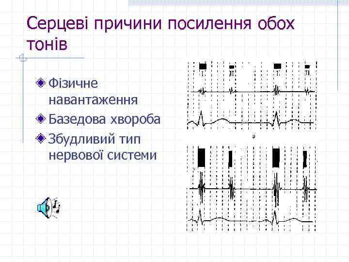 Серцеві причини посилення обох тонів Фізичне навантаження Базедова хвороба Збудливий тип нервової системи 