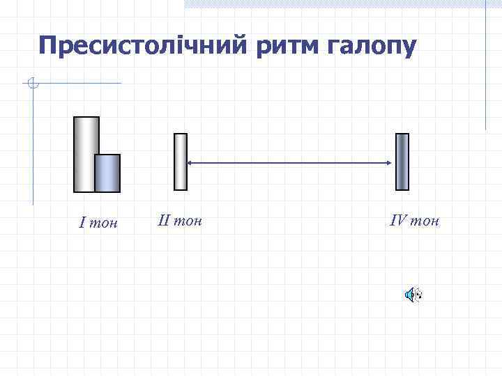 Пресистолічний ритм галопу І тон ІV тон 