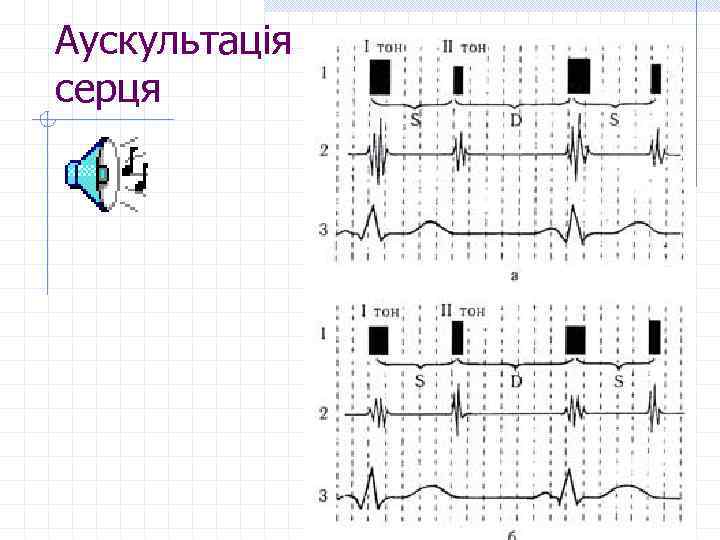 Аускультація серця 