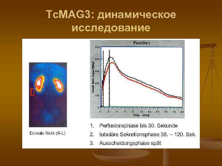 Tc. MAG 3: динамическое исследование 