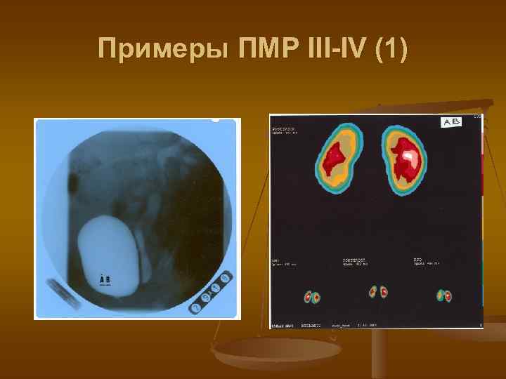 Примеры ПМР III-IV (1) 