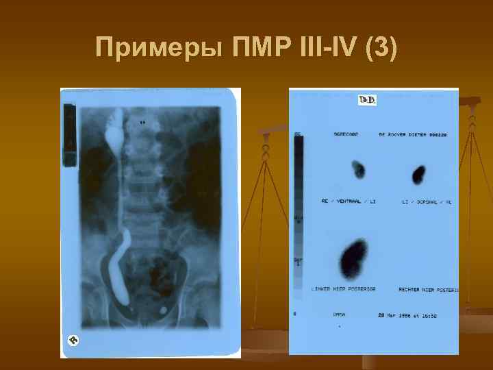 Примеры ПМР III-IV (3) 