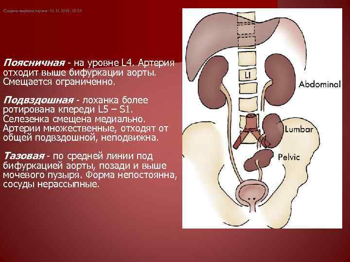  Создана вырезка экрана: 01. 11. 2009; 15: 55 Поясничная - на уровне L