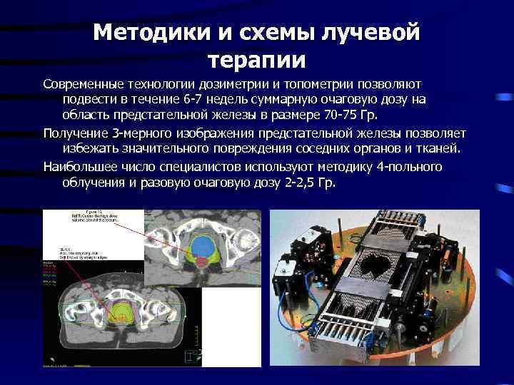 Методики и схемы лучевой терапии Современные технологии дозиметрии и топометрии позволяют подвести в течение