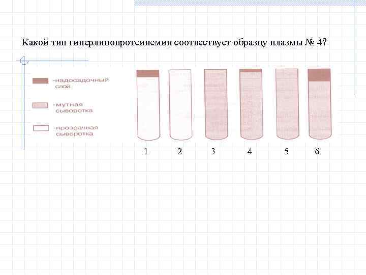 Какой тип гиперлипопротеинемии соотвествует образцу плазмы № 4? 1 2 3 4 5 6