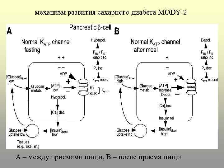 Механизм диабета 1 типа. Механизм развития сахарного диабета. Mody диабет. Сахарный диабет mody-типа. Механизм развития сахарного диабета 1 и 2 типа.