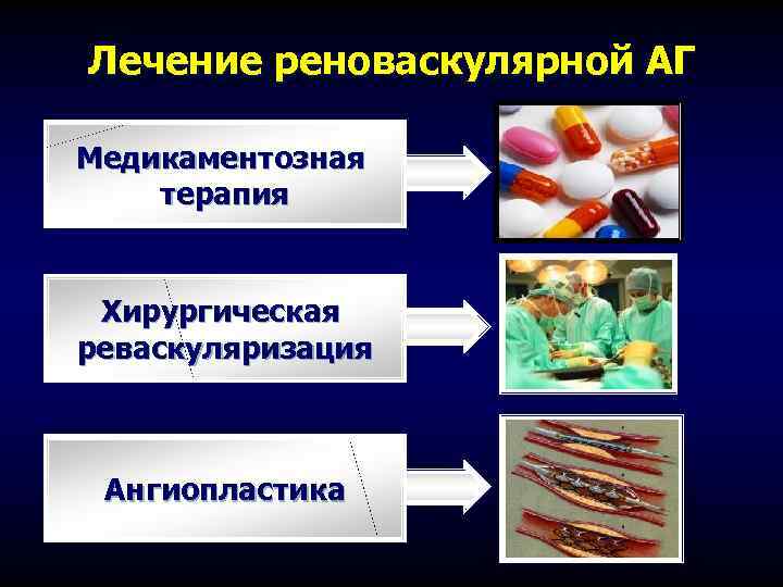 Лечение реноваскулярной АГ Медикаментозная терапия Хирургическая реваскуляризация Ангиопластика 