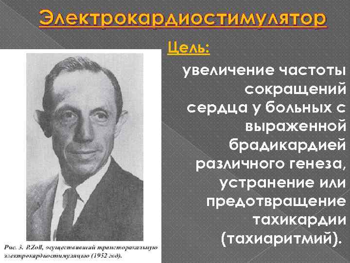 Электрокардиостимулятор Цель: увеличение частоты сокращений сердца у больных с выраженной брадикардией различного генеза, устранение