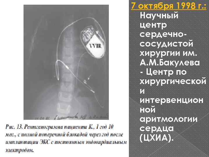 7 октября 1998 г. : Научный центр сердечнососудистой хирургии им. А. М. Бакулева -