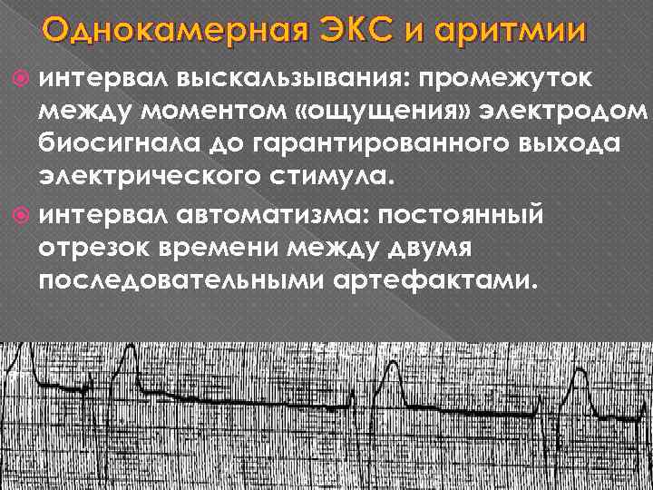 Однокамерная ЭКС и аритмии интервал выскальзывания: промежуток между моментом «ощущения» электродом биосигнала до гарантированного