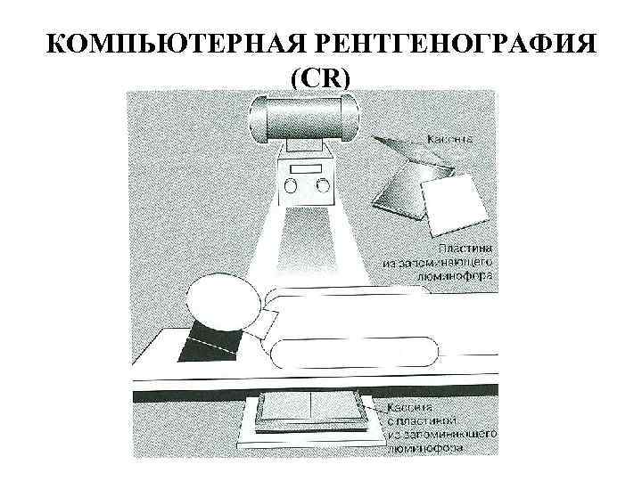 Рентгенография с прямым увеличением изображения применяется тест