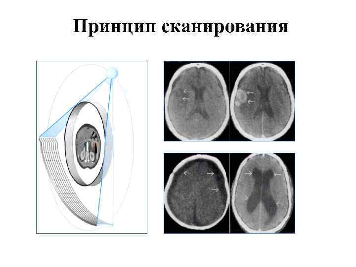 Принцип сканирования 