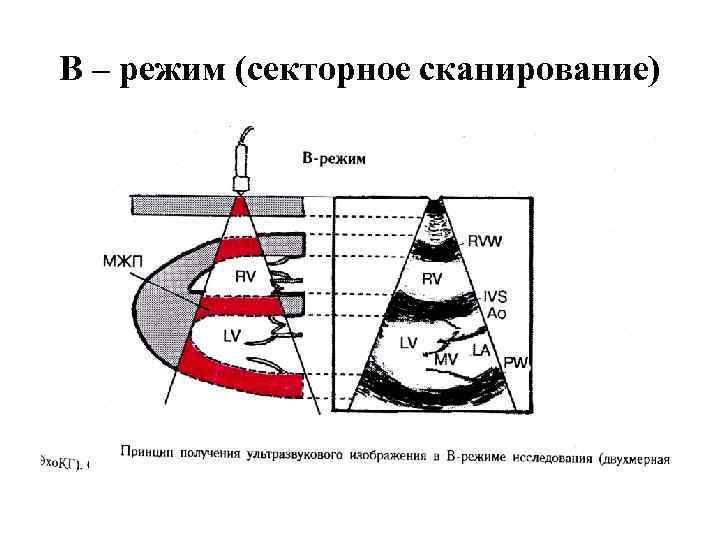 В – режим (секторное сканирование) 