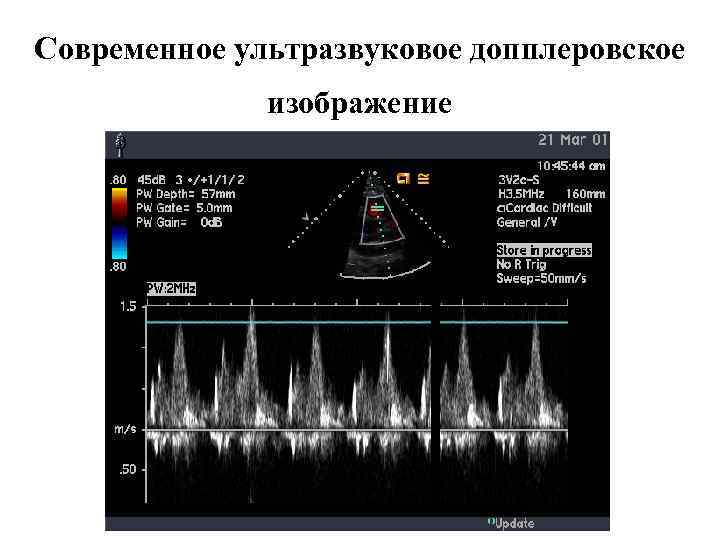 Современное ультразвуковое допплеровское изображение 