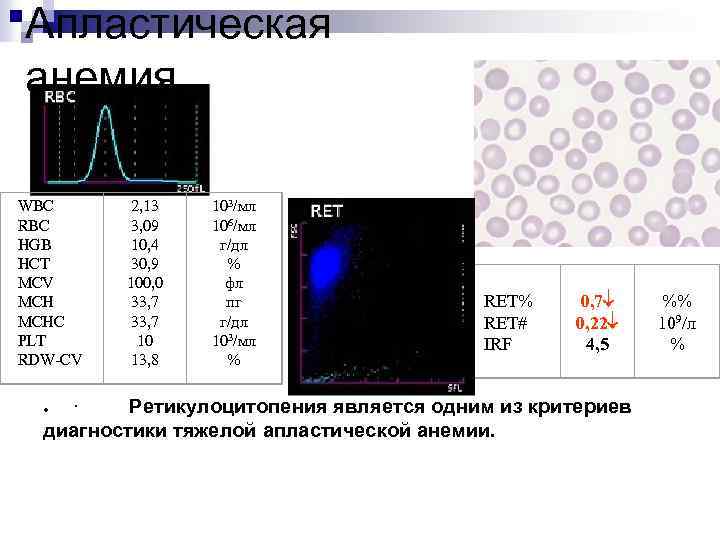 Апластическая анемия WBC RBC HGB HCT MCV MCHC PLT RDW-CV 2, 13 3, 09