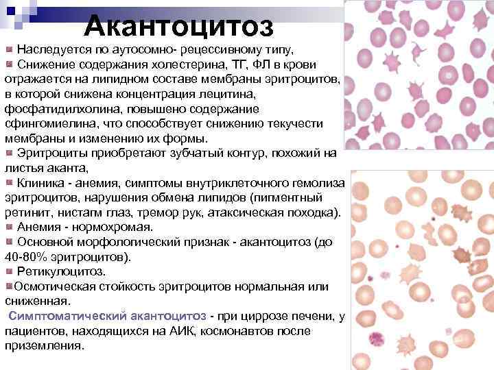 Эритроциты понижены в крови у мужчин причины. Акантоцитоз. Наследственный акантоцитоз. Акантоциты в мазке крови. Акантоциты причины.