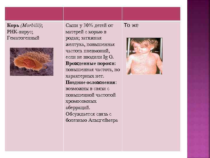 Корь (Morbilli); РНК-вирус; Гематогенный Сыпи у 30% детей от То же матерей с корью