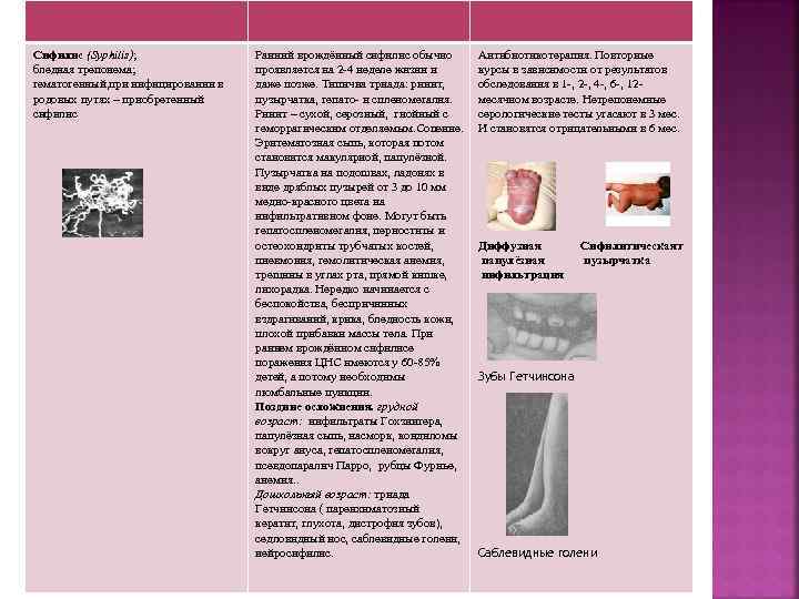 Сифилис (Syphilis); бледная трепонема; гематогенный, при инфицировании в родовых путях – приобретенный сифилис Ранний