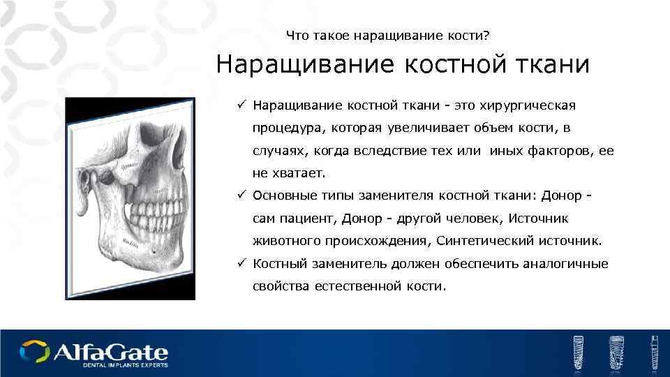 Что такое наращивание кости? Наращивание костной ткани ü Наращивание костной ткани - это хирургическая