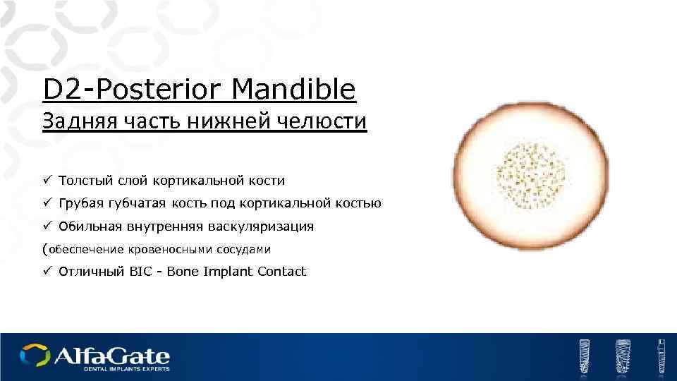 D 2 -Posterior Mandible Задняя часть нижней челюсти ü Толстый слой кортикальной кости ü