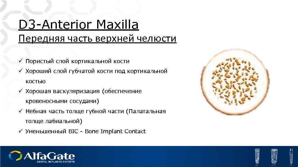 D 3 -Anterior Maxilla Передняя часть верхней челюсти ü Пористый слой кортикальной кости ü