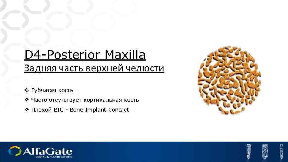 D 4 -Posterior Maxilla Задняя часть верхней челюсти v Губчатая кость v Часто отсутствует