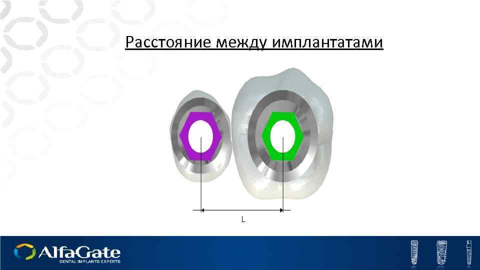 Расстояние между имплантатами 