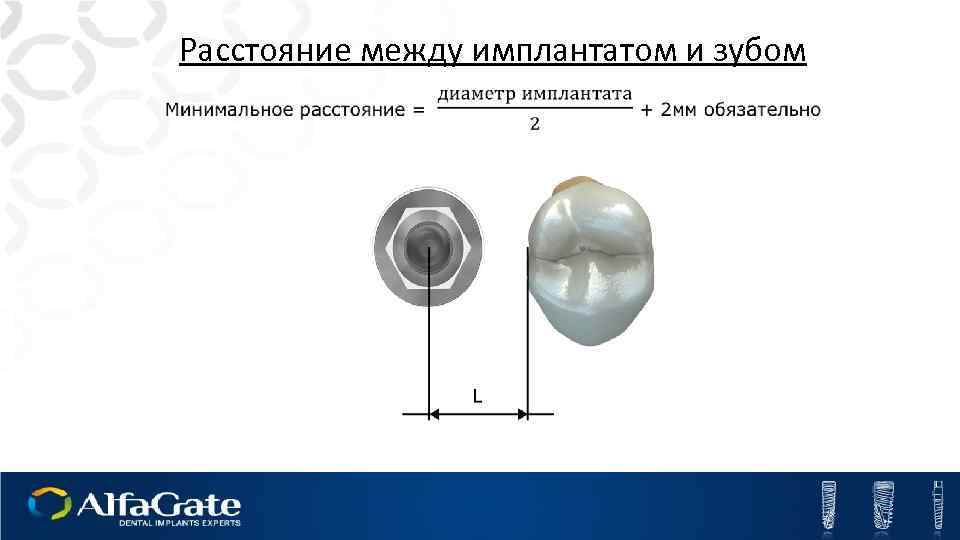 Расстояние между имплантатом и зубом 