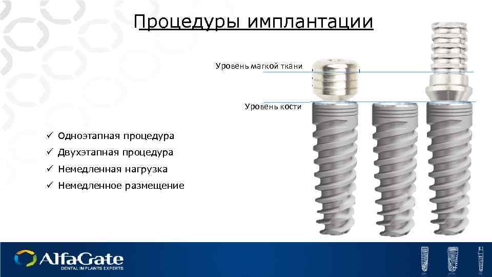 Процедуры имплантации Уровень магкой ткани Уровень кости ü Одноэтапная процедура ü Двухэтапная процедура ü