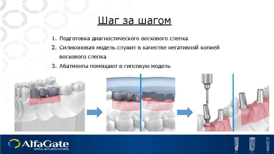 Шаг за шагом 1. Подготовка диагностического воскового слепка 2. Силиконовая модель служит в качестве