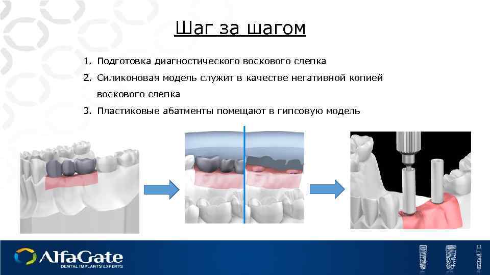 Шаг за шагом 1. Подготовка диагностического воскового слепка 2. Силиконовая модель служит в качестве