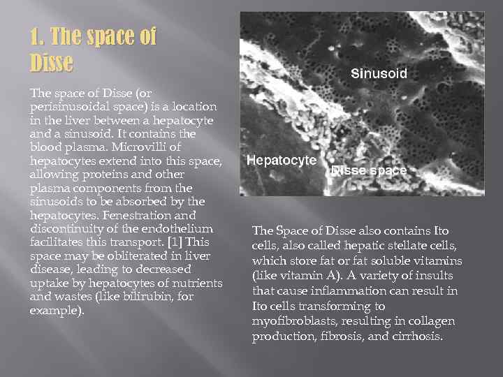 1. The space of Disse (or perisinusoidal space) is a location in the liver